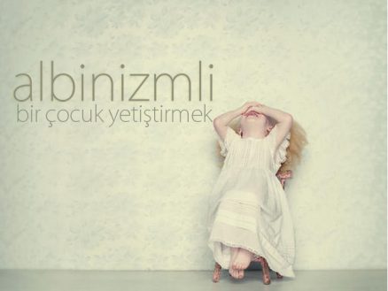 Albinizmli Bir Çocuk Yetiştirmek - Görsel 4